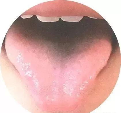 130 High-Definition Tongue Diagnosis Charts (Recommended for Collection)