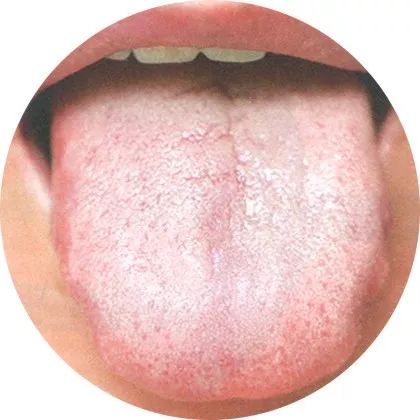 The Most Comprehensive High-Definition Real Tongue Diagnosis: Observing Tongue Patterns to Understand Internal Organs (Collection Edition)