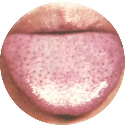 The Most Comprehensive High-Definition Real Tongue Diagnosis: Observing Tongue Patterns to Understand Internal Organs (Collection Edition)