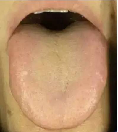 Symptoms and Dietary Remedies for Blood Deficiency, Blood Stasis, Blood Cold, and Blood Heat
