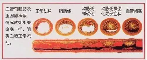 Understanding Weak Pulses: Is It Really a Sign of Deficiency?