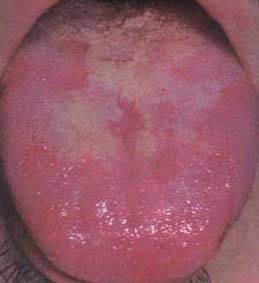 62 High-Definition Tongue Diagnosis Charts with Illustrations (Collector's Edition)