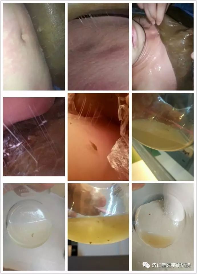 Understanding the Six Evils in Traditional Chinese Medicine