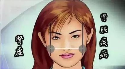 Comprehensive Guide to Facial Diagnosis in Traditional Chinese Medicine (With Images and Explanations)