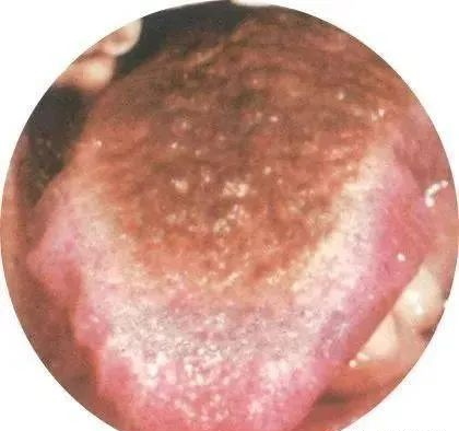 130 High-Definition Tongue Diagnosis Charts (Recommended for Collection)
