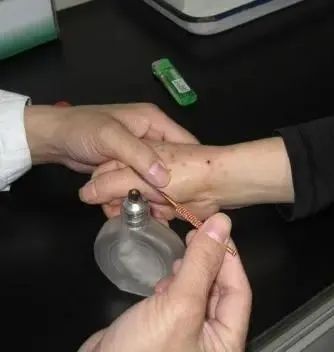 The Powerful Energy of Fire Needles