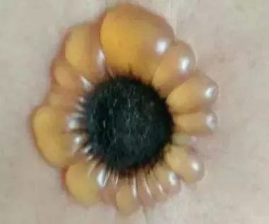The Most Comprehensive Explanation of Moxibustion Methods and Techniques (A Must-Read for Beginners)