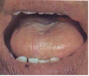 61 High-Definition Tongue Diagnosis Charts: A Visual Reference Collection