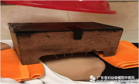 Warming Yang and Nourishing Kidney with Moxa Culture