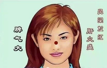 Comprehensive Guide to Facial Diagnosis in Traditional Chinese Medicine (With Images and Explanations)
