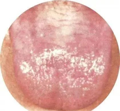 130 High-Definition Tongue Diagnosis Charts (Recommended for Collection)