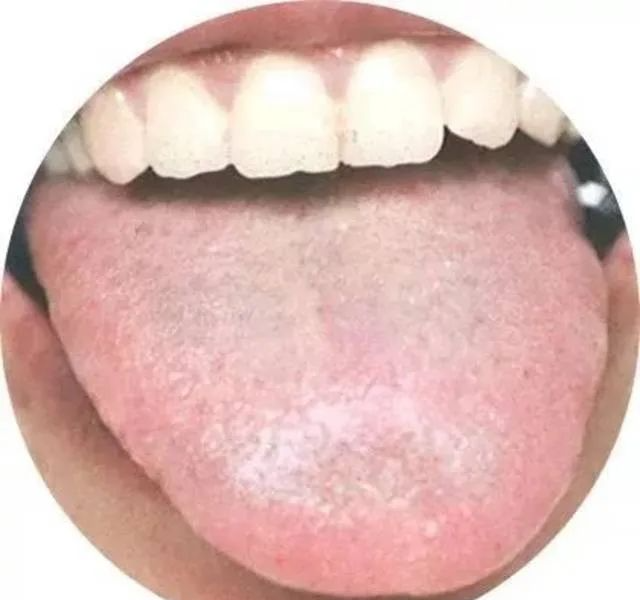 130 High-Definition Tongue Diagnosis Charts (Recommended for Collection)