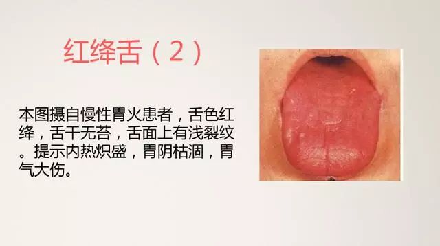 The Most Comprehensive TCM Tongue Diagnosis Atlas: Observe the Tongue, Understand the Whole Body!