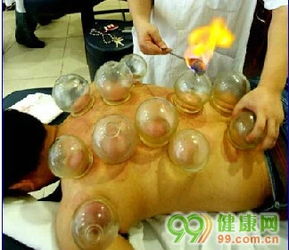 The Techniques and Diagnosis of Cupping and Sliding Cupping in Traditional Chinese Medicine