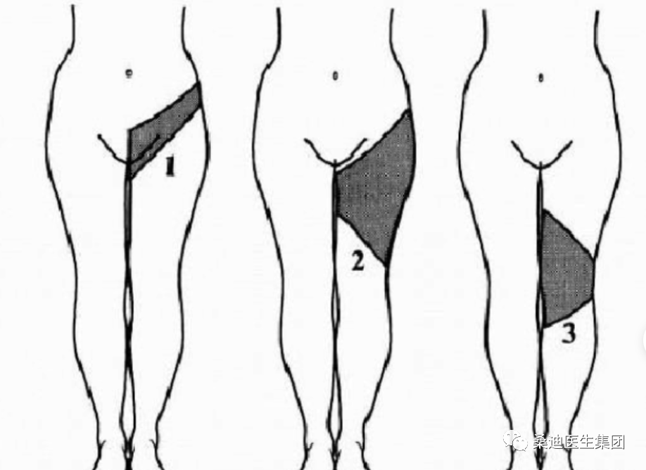 Diagnosis and Inquiry of Low Back Pain