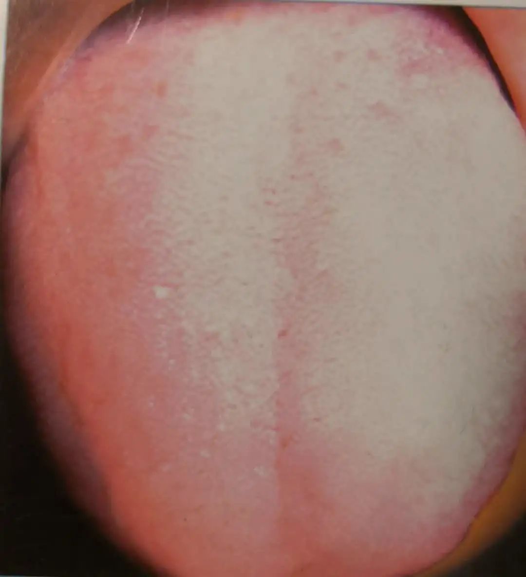 Inheritance of Traditional Chinese Medicine at Zhigu Tang | Basic Theory of TCM Lesson 34 (Tongue Diagnosis: Tongue Color)
