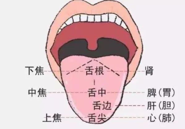Understanding Tongue Coating in Traditional Chinese Medicine