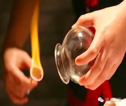 Cupping Therapy: An Art of Healing