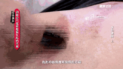 Gua Sha for All Ailments: The Importance of Correct Technique!