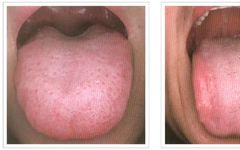 Analysis of Tongue Quality and Movement in Traditional Chinese Medicine