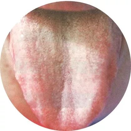 The Most Comprehensive High-Definition Real Tongue Diagnosis: Observing Tongue Patterns to Understand Internal Organs (Collection Edition)
