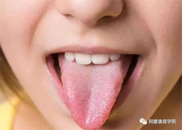 A Comprehensive Guide to 22 High-Definition Tongue Diagnosis Images: Understand Diseases Through Tongue Observation!