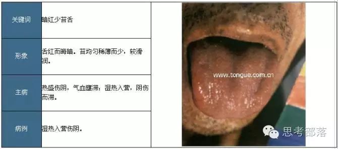 Comprehensive Guide to Tongue Diagnosis (8): 72 Types of Tongue Diagnosis Charts