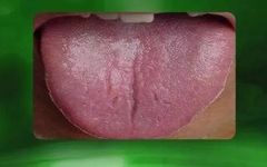 The TCM Tongue Diagnosis Atlas is Here! Observe the Tongue to Understand the Whole Body!