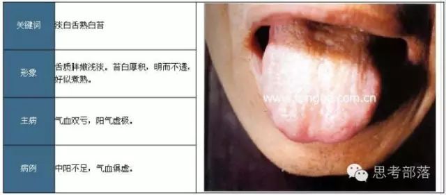 Comprehensive Guide to Tongue Diagnosis (8): 72 Types of Tongue Diagnosis Charts