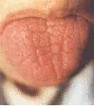 Comprehensive Guide to Tongue Diagnosis: Easily Understand Your Health Condition