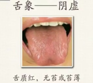 Comprehensive Guide to Tongue Diagnosis (Tongue Manifestations)