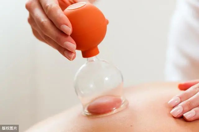 The Art of Cupping in Traditional Chinese Medicine: 5 Contraindications and Analysis of Cupping Marks