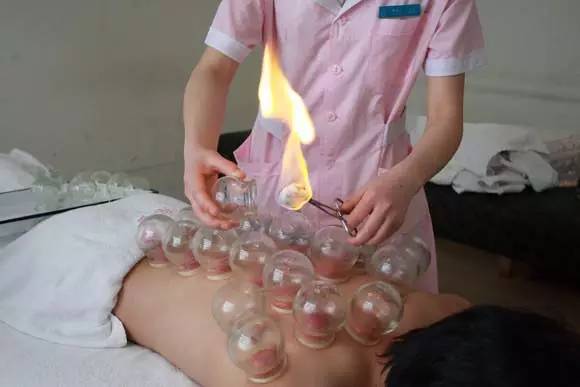 The Benefits of Bloodletting Therapy in Traditional Chinese Medicine