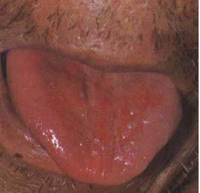 62 High-Definition Tongue Diagnosis Charts with Illustrations (Collector's Edition)