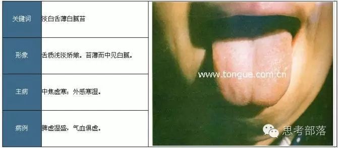 Comprehensive Guide to Tongue Diagnosis (8): 72 Types of Tongue Diagnosis Charts