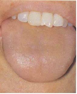 61 High-Definition Tongue Diagnosis Charts: A Visual Reference Collection