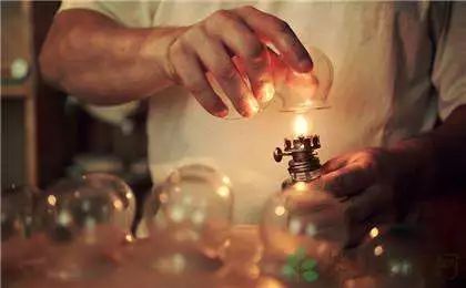 The Marvelous Cupping Therapy in Traditional Chinese Medicine: Many Benefits, but Not for Everyone!