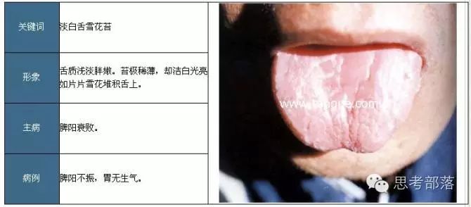 Comprehensive Guide to Tongue Diagnosis (8): 72 Types of Tongue Diagnosis Charts