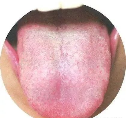 130 High-Definition Tongue Diagnosis Charts (Recommended for Collection)