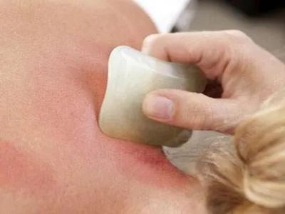 The Effects and Benefits of Gua Sha, Contraindications and Precautions