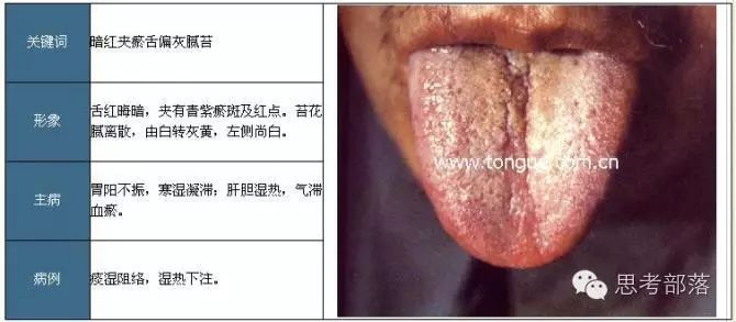 Comprehensive Guide to Tongue Diagnosis (8): 72 Types of Tongue Diagnosis Charts