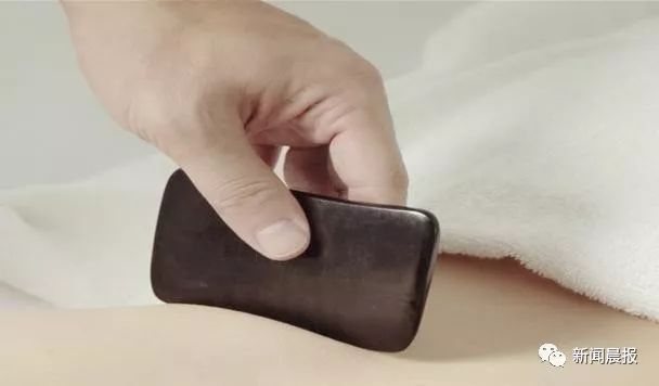 Caution: A Male Celebrity's Bare Back Photo Startles Netizens - Important Tips for Gua Sha This Summer