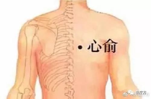 Comprehensive Guide to Cupping Therapy for the Back