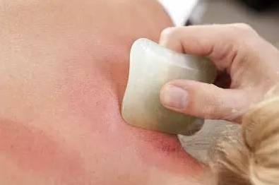Benefits and Effects of Gua Sha on the Shoulders and Neck