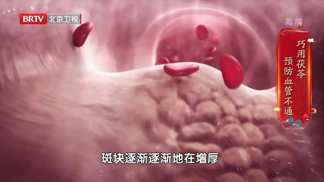 Nourishing the Heart Requires Warming Yang! Master Wang Qingguo's Three 'Secret Medicines' to Revitalize Heart Yang, Tonify Heart Qi, Calm the Spirit, and Alleviate Chest Pain!