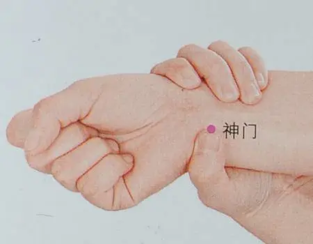 47 Unique Acupuncture Points Worth Seeing! (Collector's Edition)