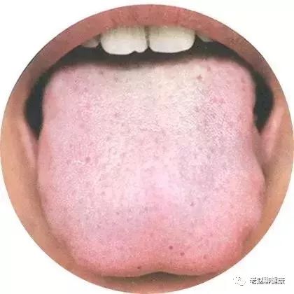 Learn Quick Ways to Observe Tongue Quality and Coating to Understand Your Health and Diseases!