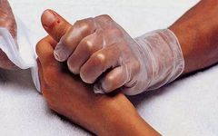 The Remarkable Bloodletting Therapy: A Solution for Various Diseases!