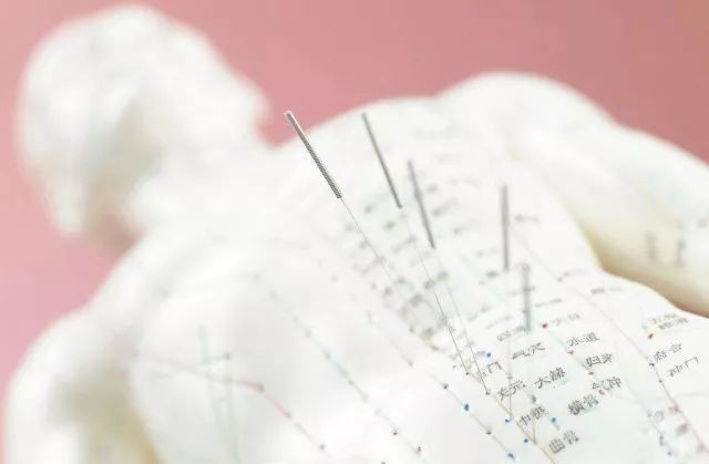 Needles and Daily Acupuncture Practice Techniques