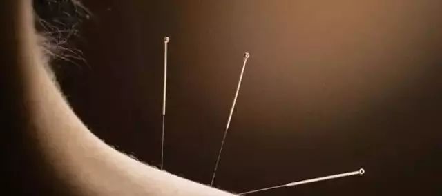 Understanding Acupuncture: Debunking Myths and Exploring Mechanisms